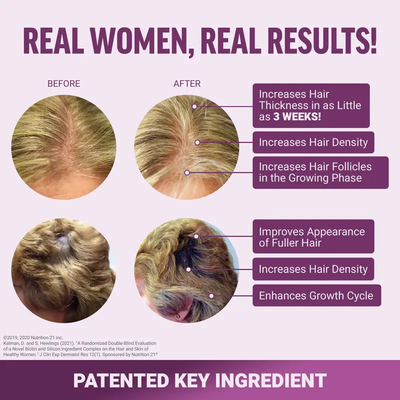 Hair Growth Accelerator – Capsules & Soft Chews, 90 Count
