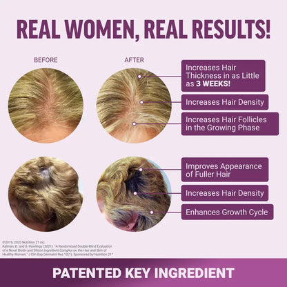 Hair Growth Accelerator – Capsules & Soft Chews, 90 Count